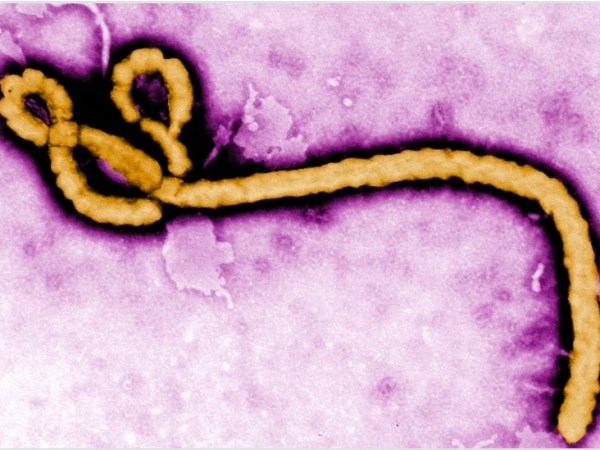 Everyone Keeps Saying the E Word: Why there are so many news reports talking about Ebola, and why we should pay&nbsp;attention